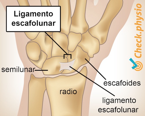 muñeca articulación escafolunar