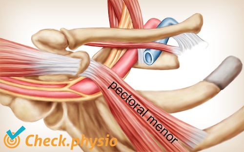 hombro brazo mano síndrome de salida torácica músculo pectoral menor